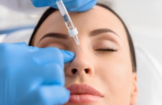 Non -operative rhinoplasty method