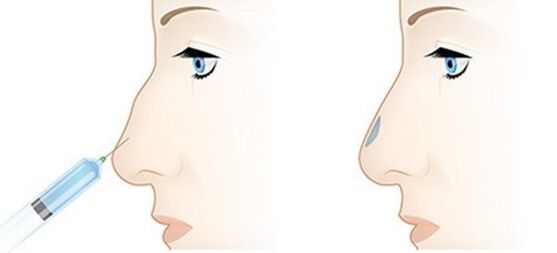 The procedure allows you to fix different problems