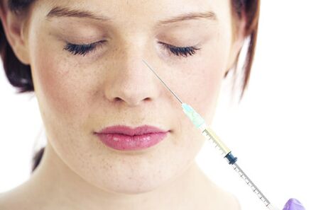 Non-surgical rhinoplasty with filler