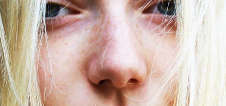 the woman's nose